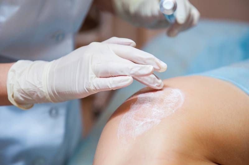 La gastroplastie endoscopique ou endosleeve laisse-t-elle des cicatrices ?